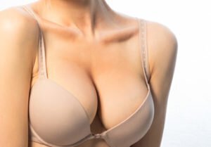 Breast Reduction Surgery FAQs