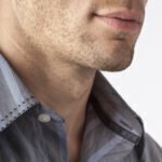 Are you interested in male chin augmentation?
