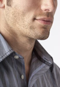 Are you interested in male chin augmentation?