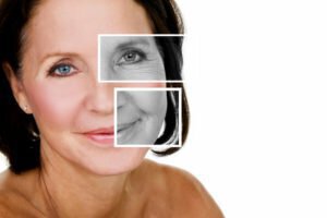 dallas botox model smiling