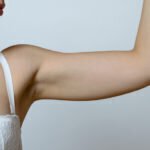 Arm Your Arms: 3 Things to Avoid After An Arm Lift