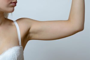 Dallas arm lift model holding up her arm