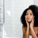 Recovering from a Chemical Peel